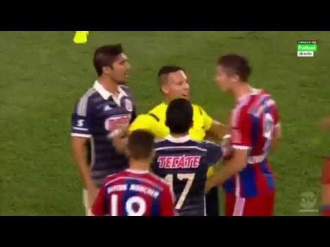 Robert Lewandowski Nervous Reaction vs Jair Pereira – FC Bayern München vs Chivas 2014 HD!