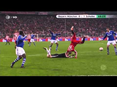 Robben vs Neuer “Bayern München 0-1 Schalke” (DFB-Pokal 02.03.2011) “HD” (Kung Fu Kick)